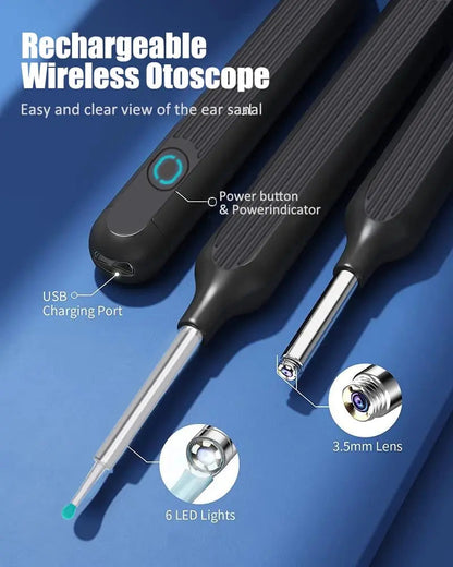 Rynx | HD Earwax Removal Spoon — Wireless Otoscope with LED Light
