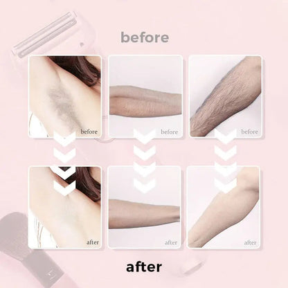 Rynx | Effortless 2-in-1 Body Hair Razor for Smooth Skin