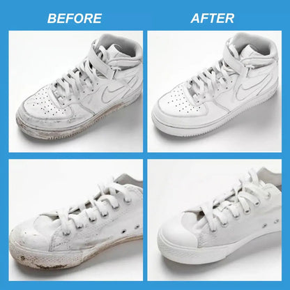 Rynx | Shoe Brightening Cleaning Gel – Bring the brightness back to your shoes