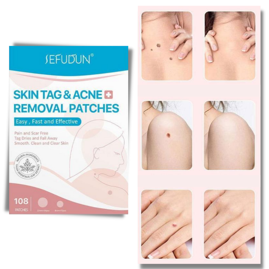 RYNX | Skin Patch - Remove Moles And Warts In A Natural Way!
