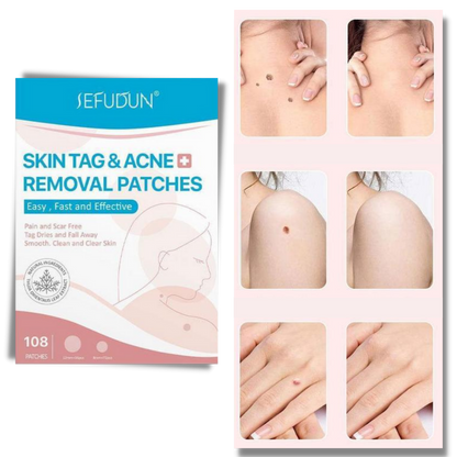 RYNX | Skin Patch - Remove Moles And Warts In A Natural Way!