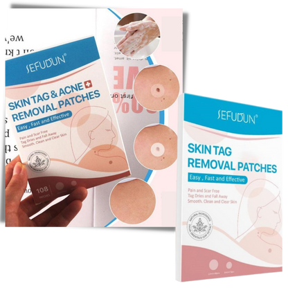 RYNX | Skin Patch - Remove Moles And Warts In A Natural Way!