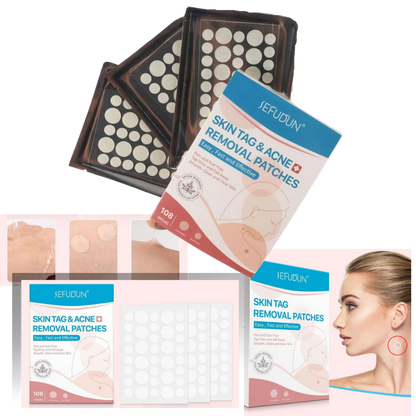 RYNX | Skin Patch - Remove Moles And Warts In A Natural Way!