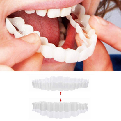 Rynx | Smile Veneer (Top & Bottom Included) Standard title