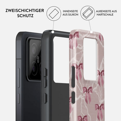 Rynx | Ballerina - Xiaomi 14 Case