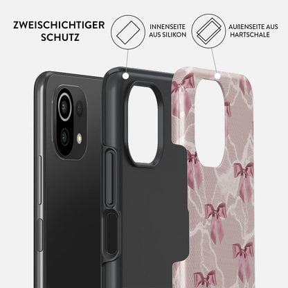 Rynx | Ballerina - Xiaomi 11 Lite 5G NE Case