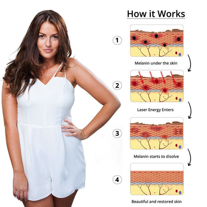 RYNX | Tattoo Removal Laser