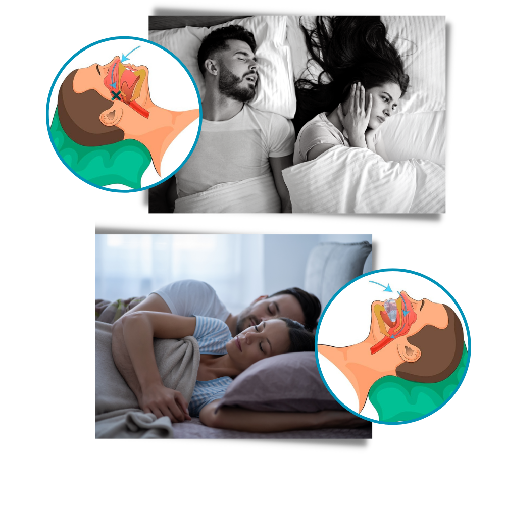 RYNX | Device – For a Peaceful Night's Sleep