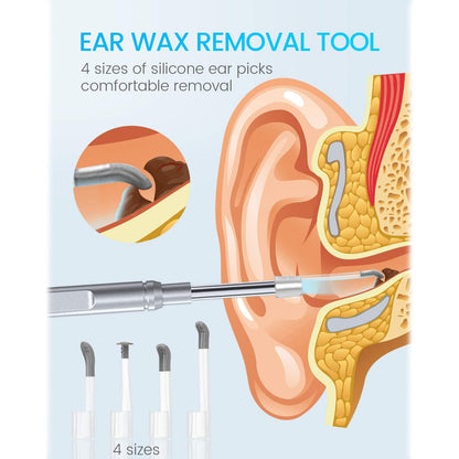 Rynx | Digital Otoscope Camera with Light