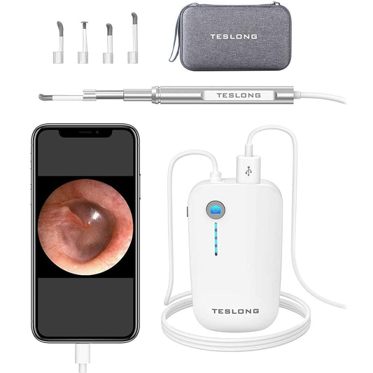 Rynx | Digital Otoscope Camera with Light