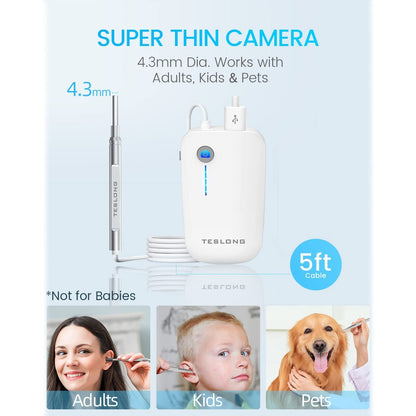 Rynx | Digital Otoscope Camera with Light