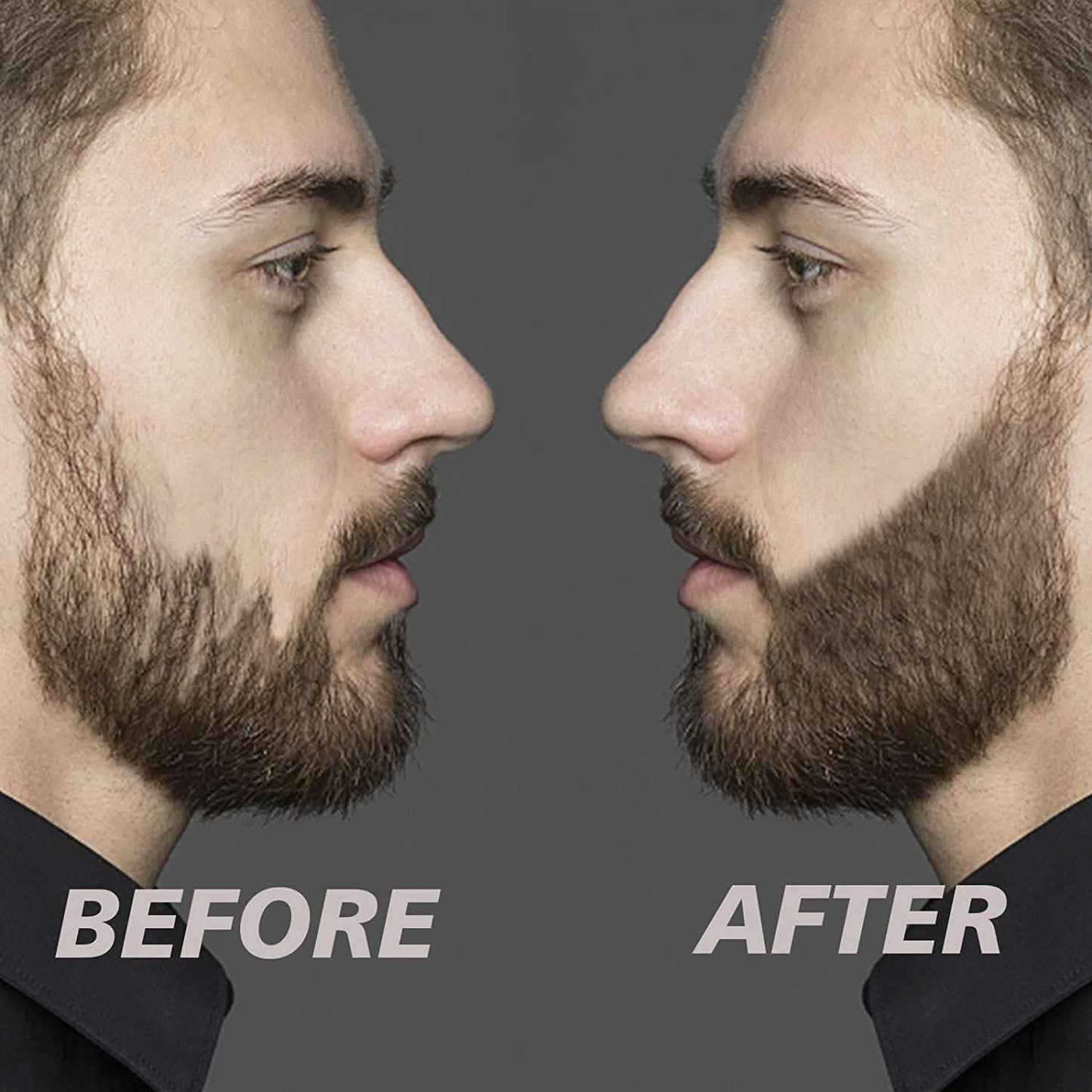 Rynx | Beard Filler Set - Tighter and Fuller Beard For All Men!