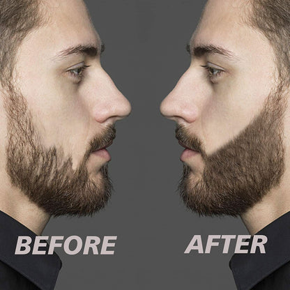 Rynx | Beard Filler Set - Tighter and Fuller Beard For All Men!