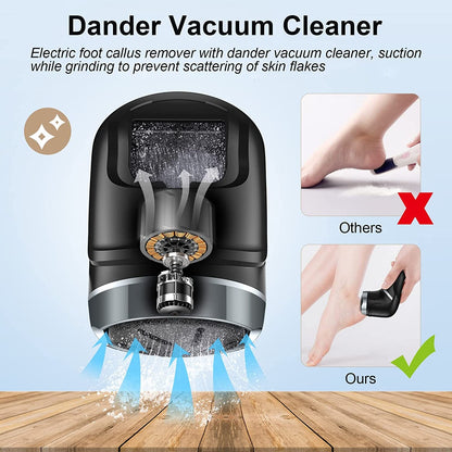 Rynx | Electric wart remover with vacuum