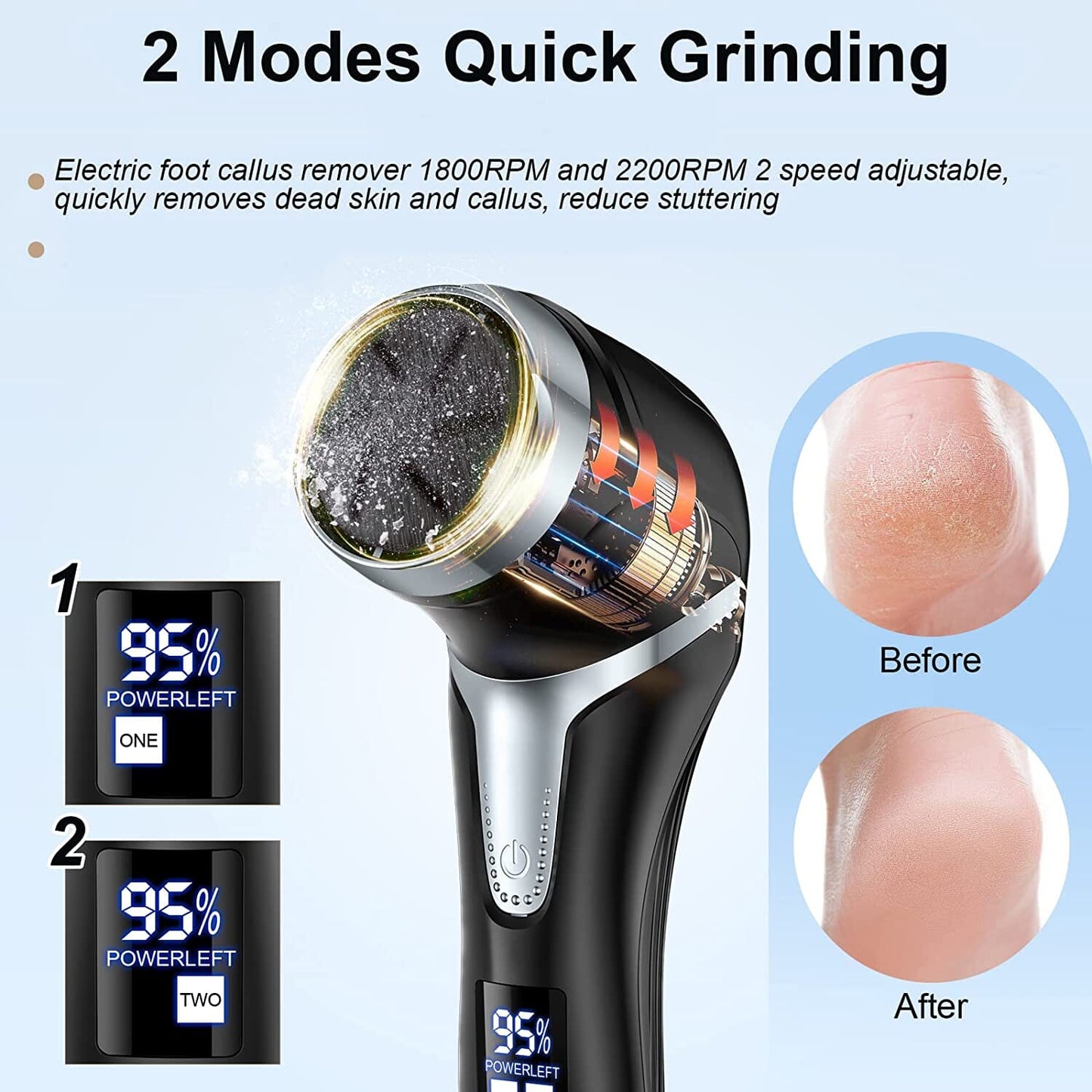 Rynx | Electric wart remover with vacuum