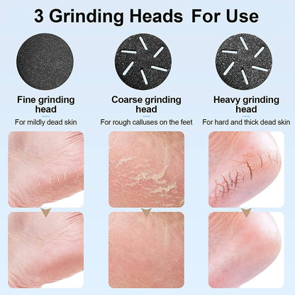 Rynx | Electric wart remover with vacuum