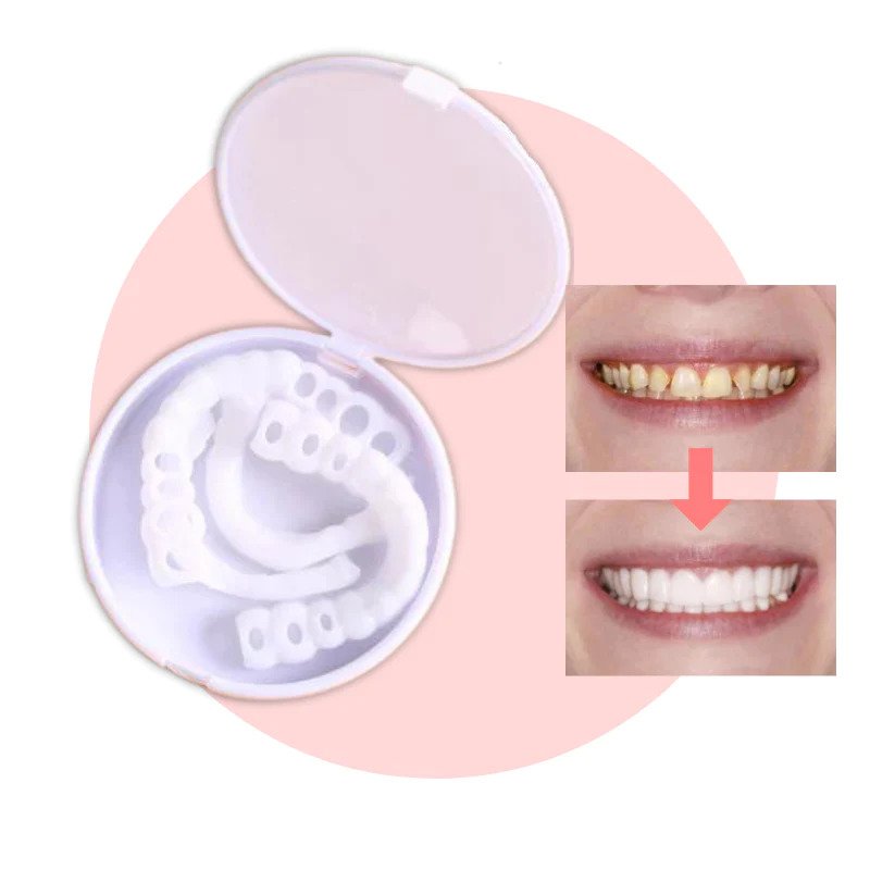 RYNX | Smilesnap - Always The Perfect Smile With These Veneers Upper and lower teeth