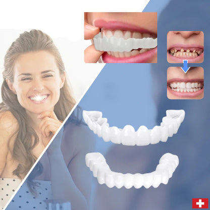 RYNX | Smilesnap - Always The Perfect Smile With These Veneers
