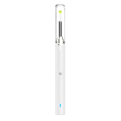 Rynx | Intelligent Visual Ear Otoscope Inspection Tool