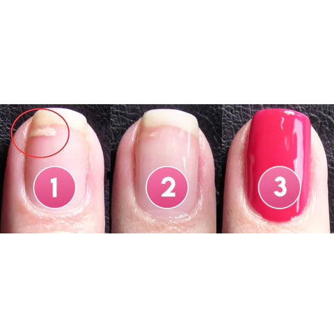 RYNX | | Restore Broken Nails Quickly and Easily