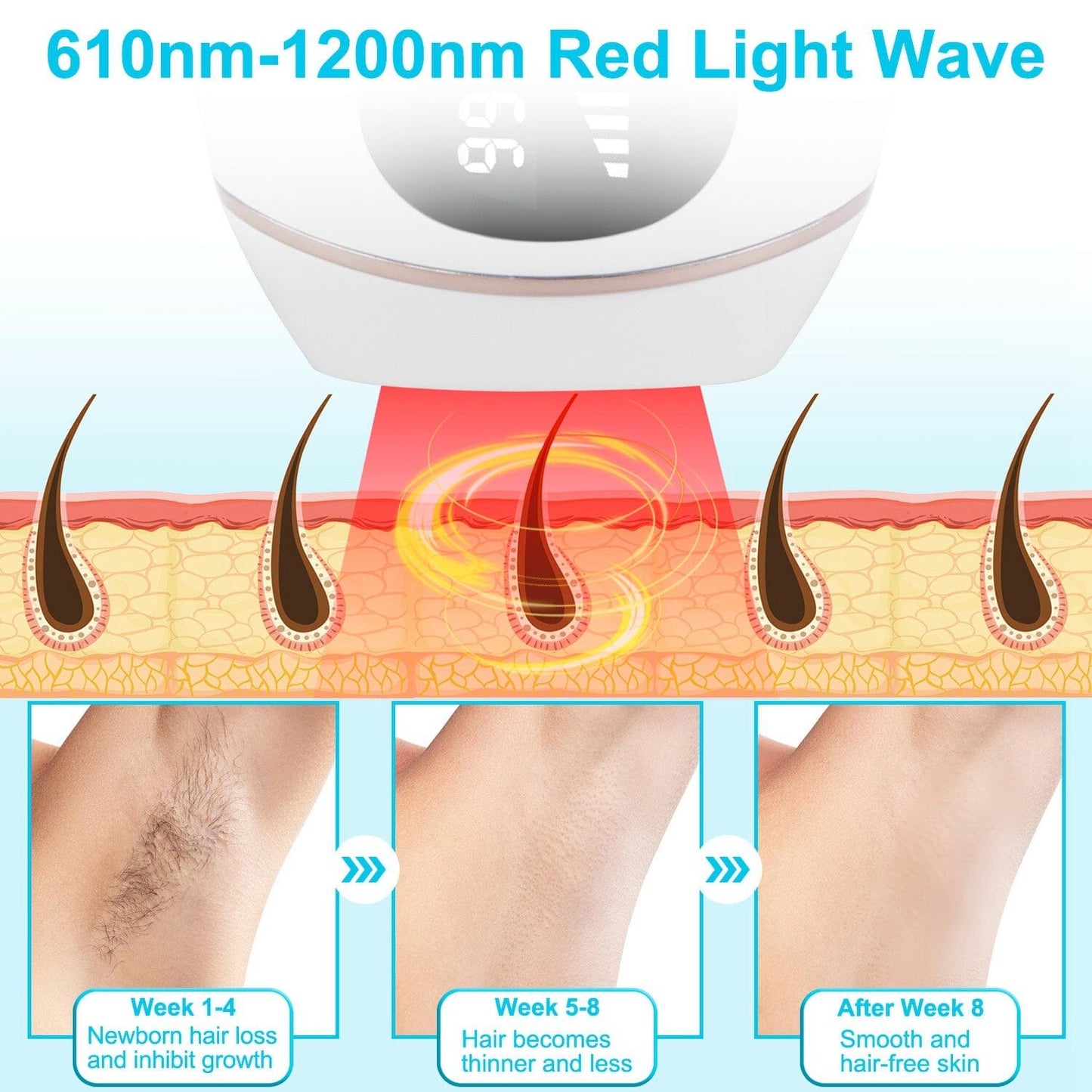 Rynx | Laser Hair Removal Ice Cooling Permanent IPL