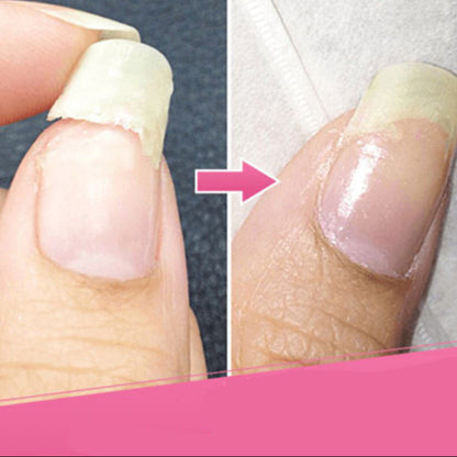 RYNX | | Restore Broken Nails Quickly and Easily