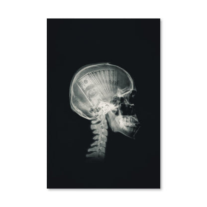 Rynx | Money Mind X-ray Canvas