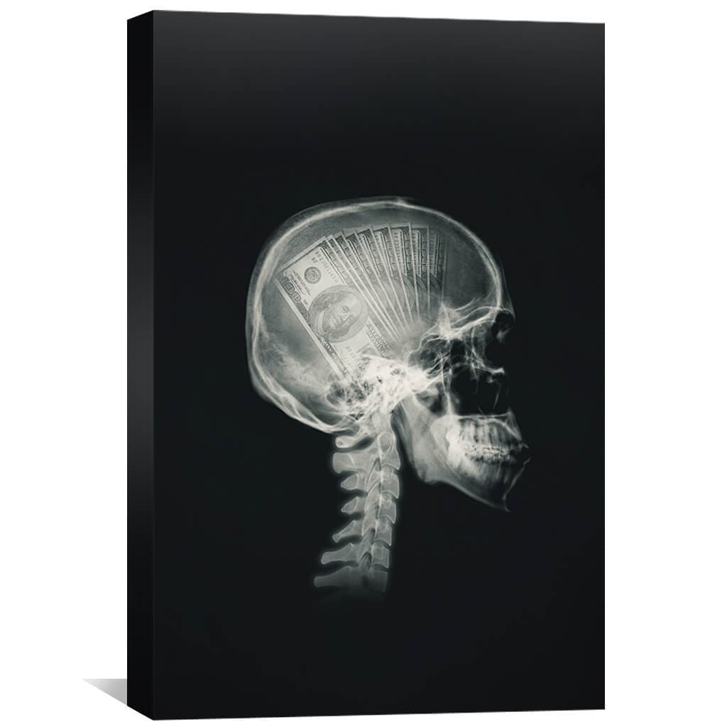 Rynx | Money Mind X-ray Canvas