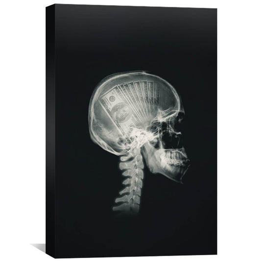 Rynx | Money Mind X-ray Canvas