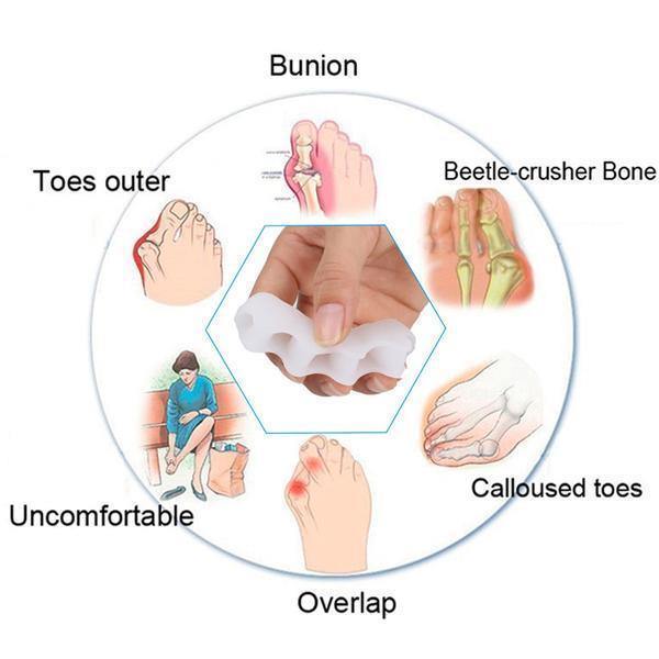 RYNX | Orthopedic Toe Corrector - Toe Separator