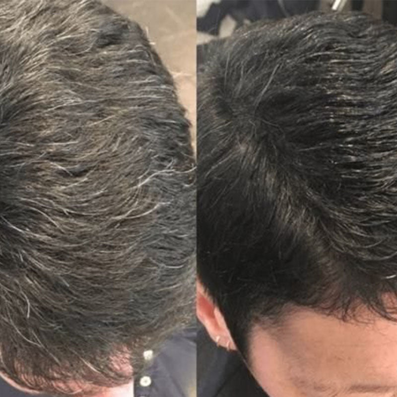 RYNX | Fast Coloring Shampoo